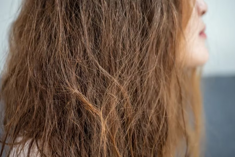 Dùng quá nhiều protein có thể “phá hoại” mái tóc của bạn