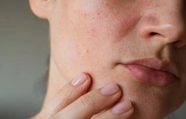 Da sạm màu, thiếu sức sống, thử ngay 4 cách chăm sóc đơn giản này