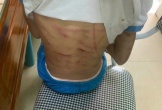 Hà Tĩnh: Cô giáo kể về bé gái bị cha dượng bạo hành bằng búa