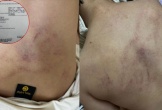 Vụ bé 4 tuổi bị giáo viên đánh, ném vào tường ở Hà Nội: Người mẹ tiết lộ câu nói gây sốc