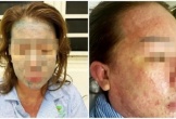 Nữ bệnh nhân nguy kịch sau khi dùng “thuốc giảm cân thải độc, collagen không rõ nguồn gốc”