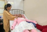 Xót xa hoàn cảnh người đàn ông bỏng nặng khi đi làm thuê kiếm tiền chạy chữa cho vợ