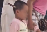 Bàng hoàng bé gái 3 tuổi được mẹ dắt vào viện với con dao cắm vào đầu