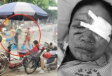 Xịt nước làm bị thương bà bán rau, bà bán cá bị khởi tố