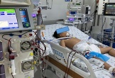 Bé trai 5 tuổi suy gan nặng, lọc máu liên tục vì 1 kiểu uống thuốc hạ sốt